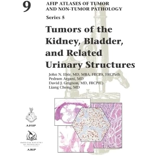 Amazon | Tumors of the Prostate Gland, Seminal Vesicles, Penis