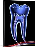 アルフレッド・Pasiekaプレミアムシックラップキャンバス壁アート印刷題名Molar Tooth 30" x 40" 1153823_24_30x40_none