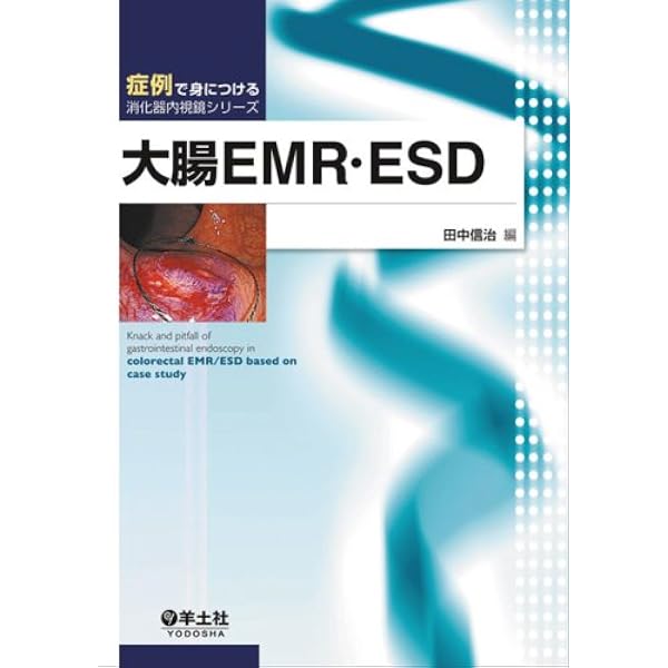 【裁断済み】大腸腫瘍内視鏡治療の要点と盲点 大腸腫瘍内視鏡治療の要点と盲点[WEB動画付き] (Knack & Pitfalls