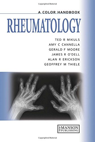 Rheumatology: A Color Handbook (Medical Color Handbook Series)の表紙