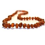 The Art of Cure Baltic Amber Teething Necklace for Baby (Raw Cognac) - Anti-inflammatory by The Art 