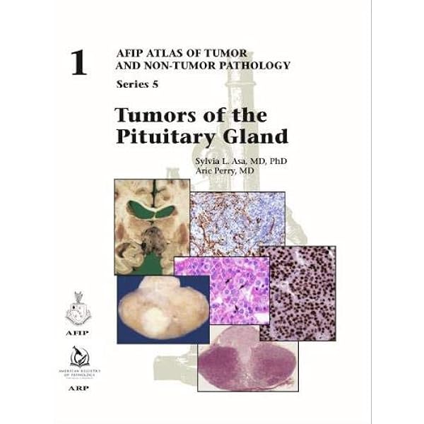 Amazon | Tumors of the Salivary Glands (AFIP Atlas of Tumor and