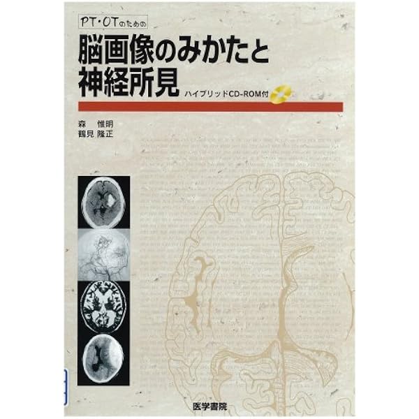 PT・OT・STのための脳画像のみかたと神経所見 | 森 惟明 |本 | 通販