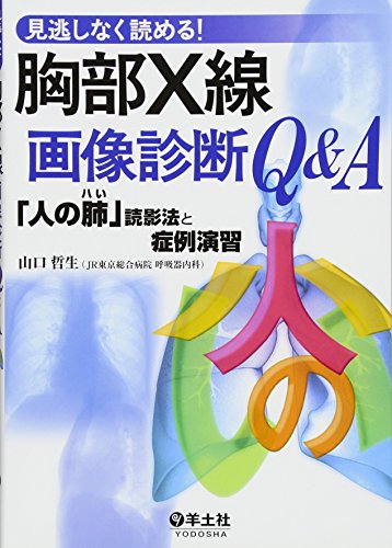 見逃しなく読める!胸部X線画像診断Q&A―「人の肺」読影法と症例演習 見逃しなく読める!胸部X線画像診断Q&A―「人の肺」読影法と症例演習