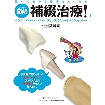 スーパー図解 補綴治療! | 土屋 賢司 |本 | 通販 | Amazon