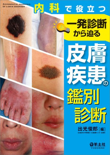 内科で役立つ 一発診断から迫る皮膚疾患の鑑別診断 内科で役立つ 一発診断から迫る皮膚疾患の鑑別診断