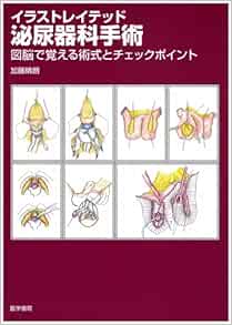 イラストレイテッド泌尿器科手術 図脳で覚える術式とチェックポイント 加藤 晴朗 本 通販 Amazon