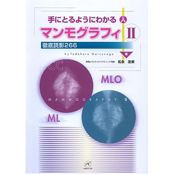 マンモグラフィII 改訂版〜読影力をアップさせる厳選62例