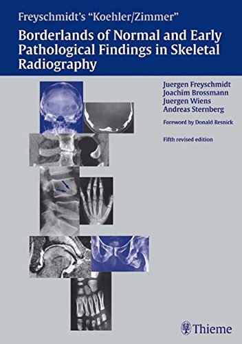 Koehler / Zimmer's Borderlands of Normal and Early Pathological Findings in Skeletal Radiographyの表紙