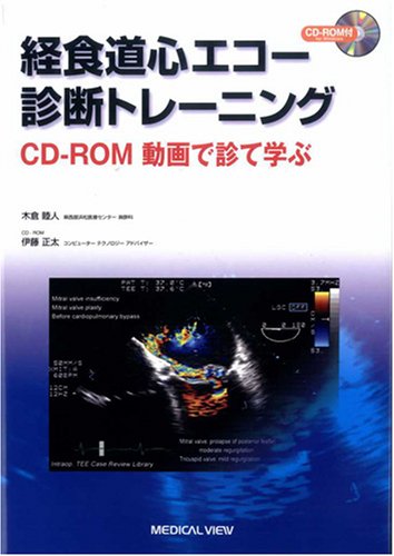 経食道心エコー診断トレーニング−CD-ROM 動画で診て学ぶ 経食道心エコー診断トレーニング−CD-ROM 動画で診て学ぶ