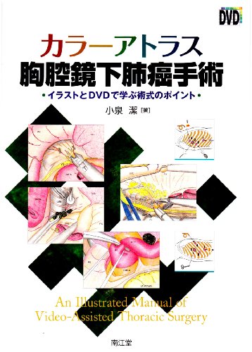 カラーアトラス胸腔鏡下肺癌手術―イラストとDVDで学ぶ術式のポイント カラーアトラス胸腔鏡下肺癌手術―イラストとDVDで学ぶ術式のポイント