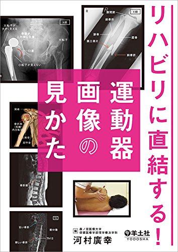 リハビリに直結する! 運動器画像の見かた リハビリに直結する! 運動器画像の見かた
