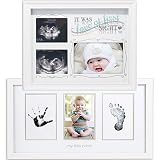 (Set) Love At First Sight Sonogram Frame & Newborn Babyprints Picture Frame by CloseoutZone