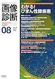 画像診断2023年8月号 Vol.43 No.9: わかる! びまん性肺疾患