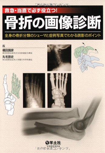 救急・当直で必ず役立つ!骨折の画像診断―全身の骨折分類のシェーマと症 救急・当直で必ず役立つ!骨折の画像診断―全身の骨折分類のシェーマと症