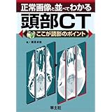正常画像と並べてわかる頭部CT (ここが読影のポイント)