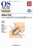 頚椎の手術―ベーシックからアドバンストまで必須テクニック [DVD付] (OS NOW Instruction)