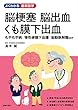 脳梗塞　脳出血　くも膜下出血 (よくわかる最新医学シリーズ)