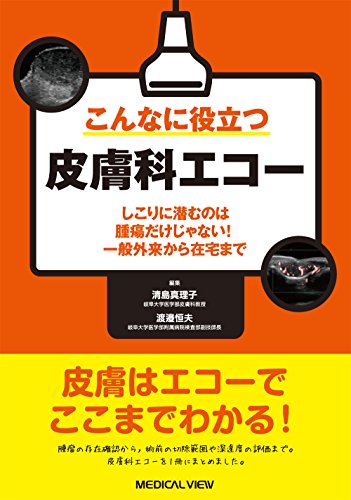 こんなに役立つ皮膚科エコー−しこりに潜むのは腫瘍だけじゃない! 一般 こんなに役立つ皮膚科エコー−しこりに潜むのは腫瘍だけじゃない! 一般