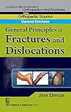 General Principles of Fractures and Dislocations