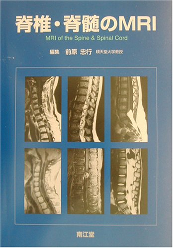 脊椎・脊髄のMRI 脊椎・脊髄のMRI