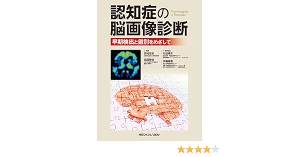 認知症の脳画像診断 早期検出と鑑別をめざして 西村 恒彦 武田 雅俊 松田 博史 伊藤 健吾 本 通販 Amazon Co Jp