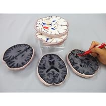 [最終価格] 脳MRI 3冊セット Amazon.co.jp: 脳MRI T1強調像 水平断脳模型 : 産業・研究開発用品