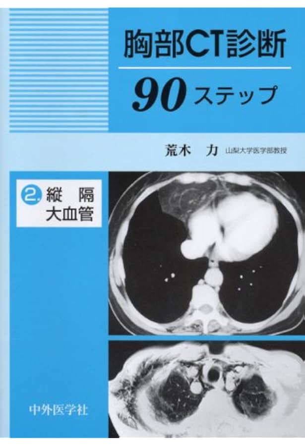 胸部のCT 胸部CT読影支援システムClearRead CT+DC | 東陽テクニカ | “はかる