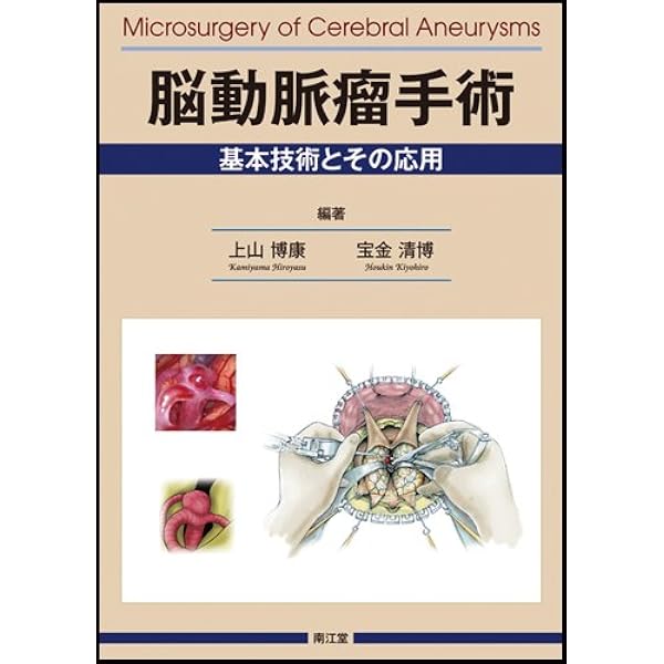 脳血行再建術 改訂2版 | 寳金 清博 |本 | 通販 | Amazon