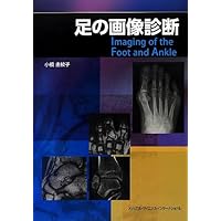 足の画像診断 [単行本] 小橋由紋子 足の画像診断 第2版 | 小橋由紋子 |本 | 通販 | Amazon