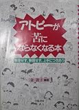 アトピーが苦にならなくなる本: 無理せず、無視せず上手につきあう