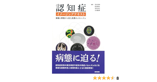 認知症イメージングテキスト 画像と病理から見た疾患のメカニズム 冨本 秀和 松田 博史 羽生 春夫 吉田 眞理 本 通販 Amazon