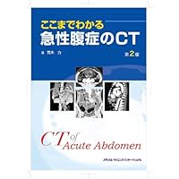 ここまでわかる急性腹症のCT 第3版 | 荒木 力 |本 | 通販 | Amazon