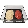 脂肪/筋肉対比セット(アクリルケース入)500g IP-981