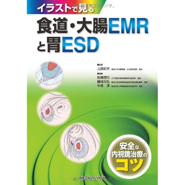 【裁断済み】大腸腫瘍内視鏡治療の要点と盲点 大腸腫瘍内視鏡治療の要点と盲点[WEB動画付き] (Knack & Pitfalls