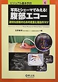 写真とシェーマでみえる!腹部エコー―適切な診断のための走査と描出のコツ (ビジュアル基本手技 6)