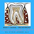 Root Canal Treatment: A patient's guide to RCT (Hindi Edition)