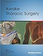 Awake Thoracic Surgery