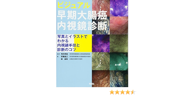 ビジュアル 早期大腸癌内視鏡診断 写真とイラストでわかる内視鏡手技と診断のコツ 昌之 安藤 昌裕 椿 邦佳 荒井 本 通販 Amazon