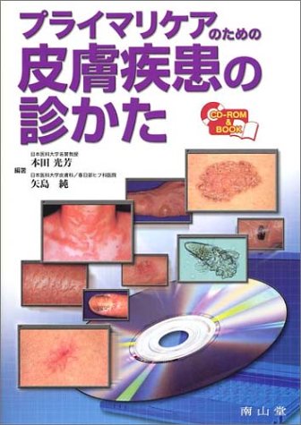 プライマリケアのための皮膚疾患の診かた CD-ROM付 プライマリケアのための皮膚疾患の診かた CD-ROM付
