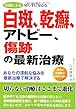 医師による切らずに安心な白斑、乾癬、アトピー、傷跡の最新治療