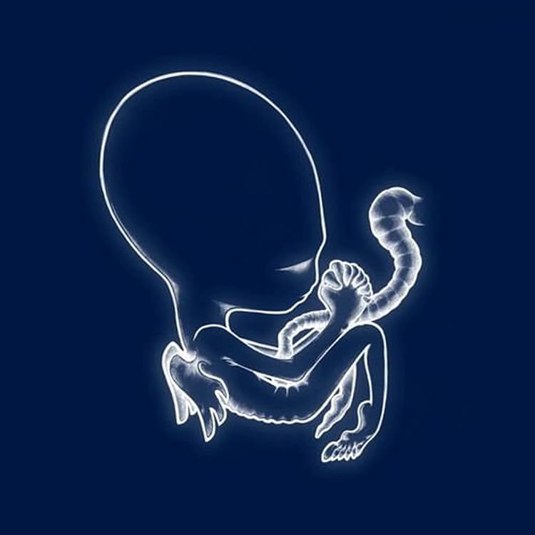 Amazon.co.jp: Sigur Ros: ミュージック