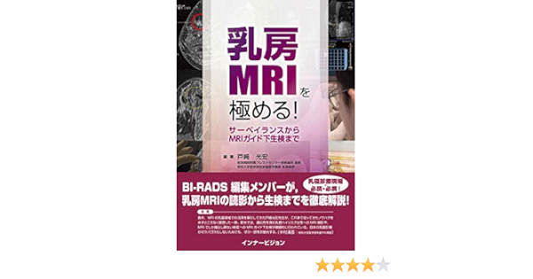 乳房mriを極める サーベイランスからmriガイド下生検まで 戸﨑 光宏 相良 安昭 大井 恭代 佐々木 道郎 戸﨑光宏 本 通販 Amazon