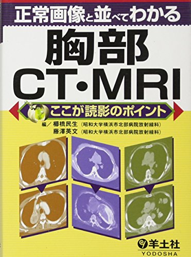 正常画像と並べてわかる胸部CT・MRI―ここが読影のポイント 正常画像と並べてわかる胸部CT・MRI―ここが読影のポイント