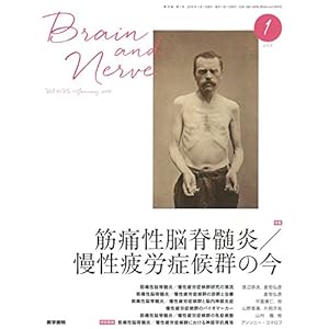 BRAIN and NERVE 神経研究の進歩 2018年 1月号 特集 筋痛性脳脊髄炎/慢性疲労症候群の今 BRAIN and NERVE 神経研究の進歩 2018年 1月号 特集 筋痛性脳脊髄炎/慢性疲労症候群の今