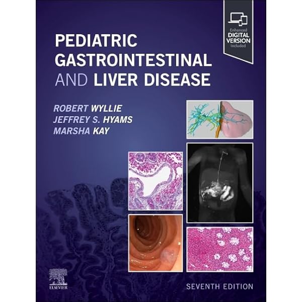 Amazon | MacSween's Pathology of the Liver | Burt BSc MBChB MD