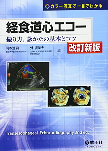 経食道心エコー―撮り方,診かたの基本とコツ 経食道心エコー―撮り方,診かたの基本とコツ