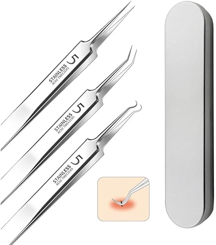 Amazon | 【IPPON】角栓ピンセット 3本セット 角栓取り 精密ピンセット