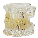 Merssavo 歯科教育成人標準歯モデル病理学歯科医実習