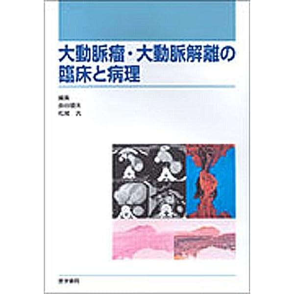 大動脈解離―診断と治療のStandard | 井元 清隆, 上田 俊彦, 安達 秀雄